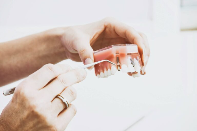 Cost of Root Canal in Dallas TX